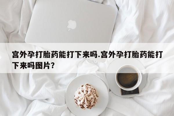 买流产药的联系方式宫外孕打胎药能打下来吗.宫外孕打胎药能打下来吗图片？
